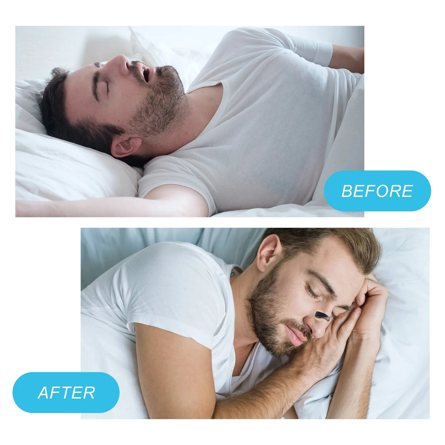 Nasal Breathing Dilators Magnetic Nose Strips